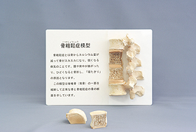 骨粗鬆症模型｜ヤガミ 商品検索システム